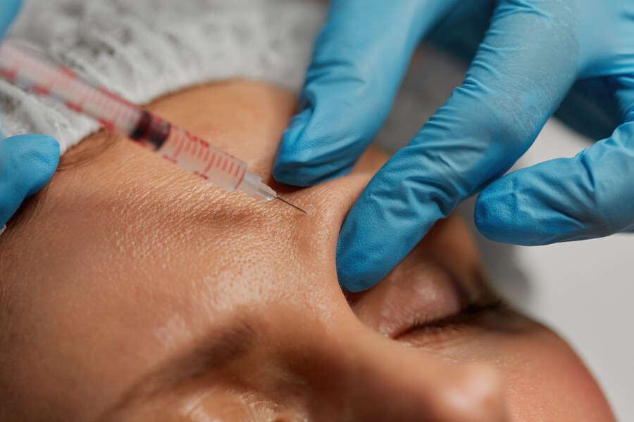 Beneficios del Botox introducción - Aplicación de inyección estética en la frente por profesional con guantes.