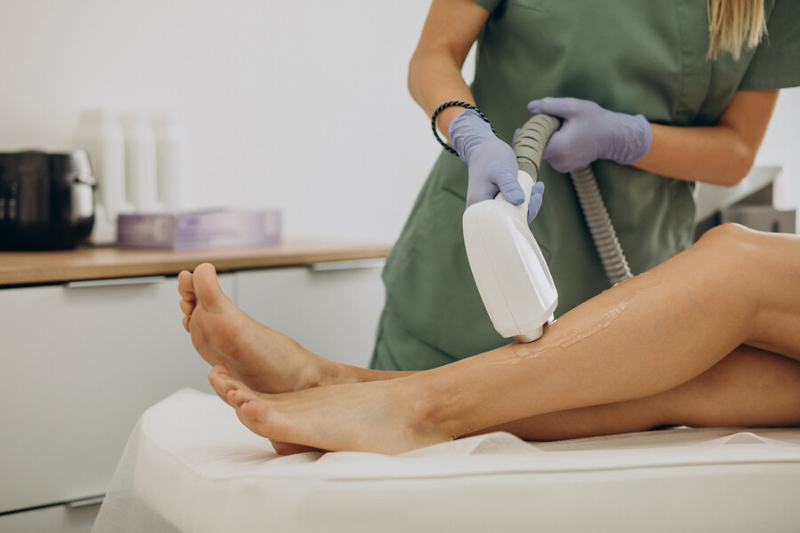Depilación con láser bikini que es - Sesión de depilación láser en pierna realizada por profesional con guantes.