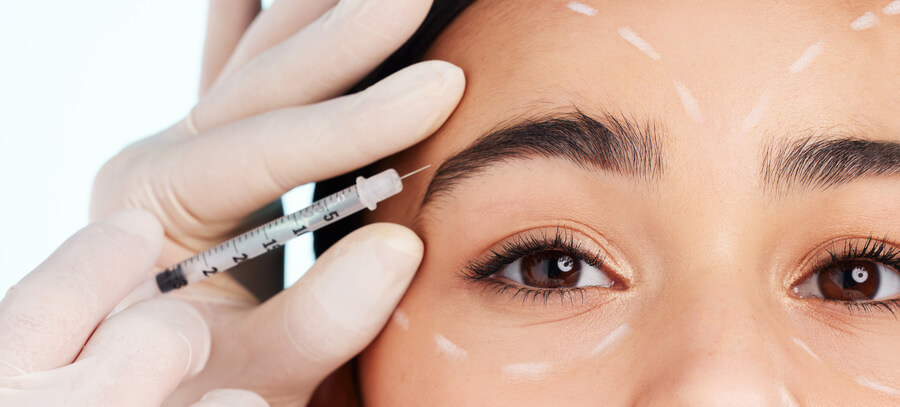 ¿A qué edad se puede comenzar con bótox preventivo?