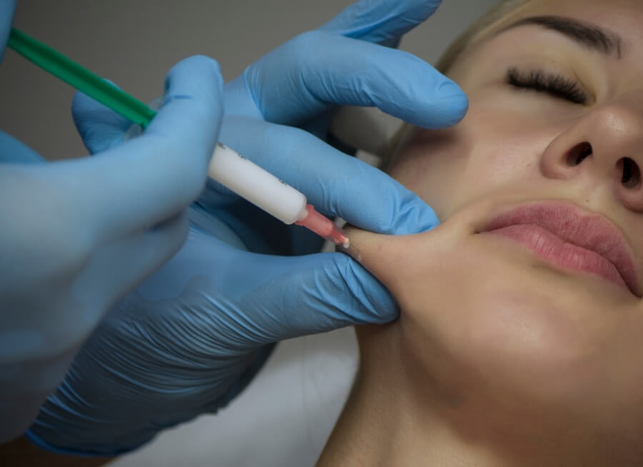 Bótox para la cara comparación - Aplicación de tratamiento estético en el rostro de una mujer por profesional con guantes azules.