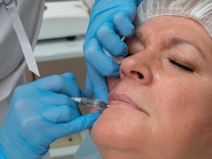 Cuidado bótox alimentos - Aplicación de relleno facial en labios para rejuvenecimiento en piel madura.