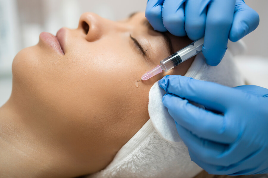 Harmonyca efectos secundarios efectos - Mujer recostada recibiendo tratamiento estético con inyección en el rostro.