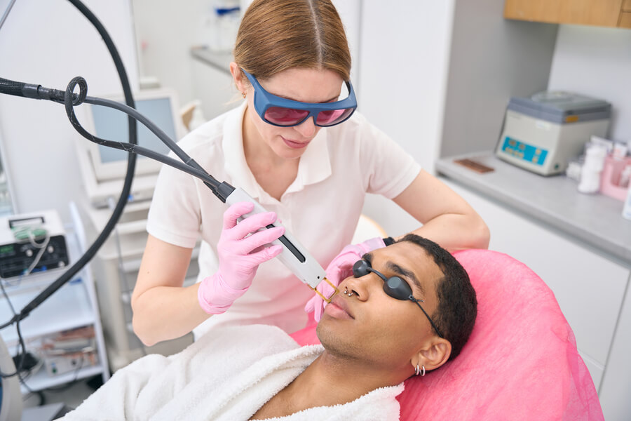 Láser co2 fraccionado para manchas funciona - Depilación láser facial en hombre, zona del bigote, con protección ocular.