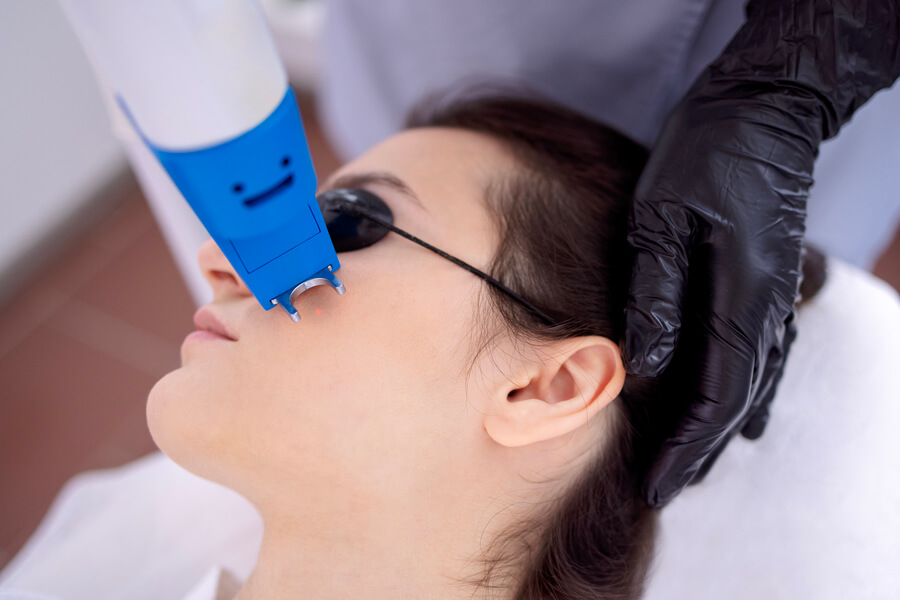 Láser co2 fraccionado para manchas testimonios - Tratamiento láser facial en la zona de las ojeras con protección ocular.