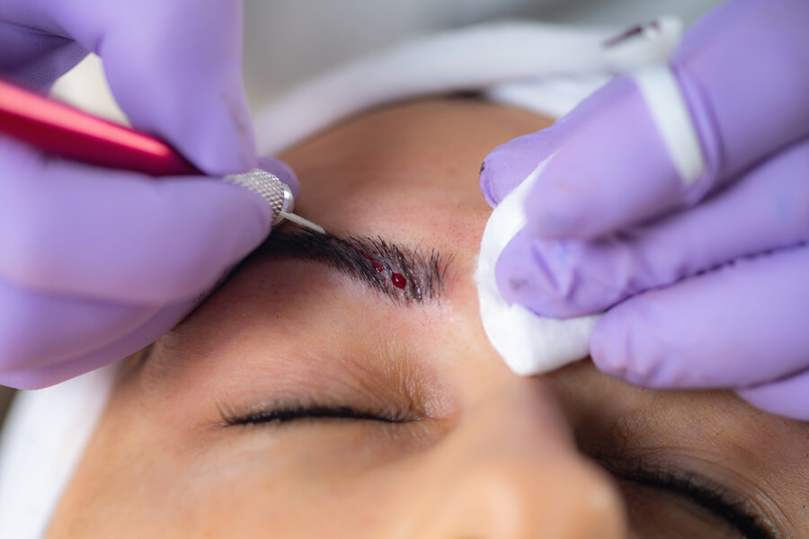 Cuanto dura la micropigmentación de cejas cuando - Procedimiento de microblading en ceja con ligera sangre mientras el especialista trabaja con guantes morados.