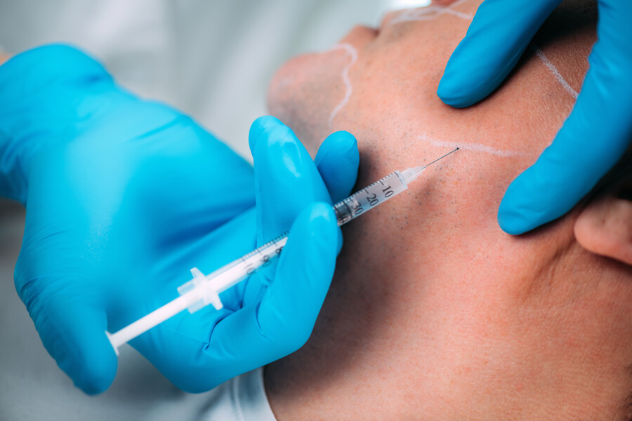 Radiesse para qué sirve introducción - Aplicación de inyección estética en el rostro por profesional con guantes.