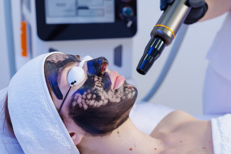 Láser CO2 Medellín proceso - Sesión láser facial.