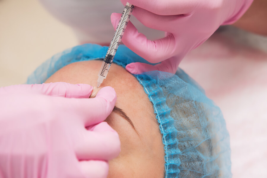 Radiesse Antes y Después resultados - Inyección estética en frente.
