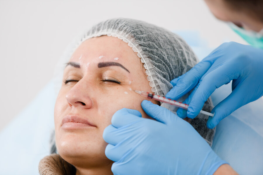 Aplicación de bótox facial.