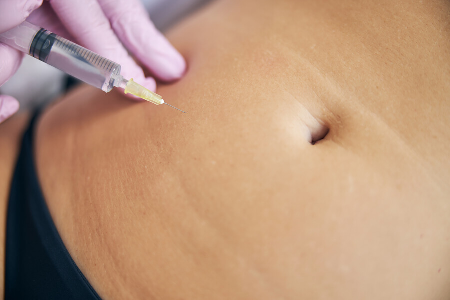 Carboxiterapia abdominal: protocolo, sesiones y resultados reales