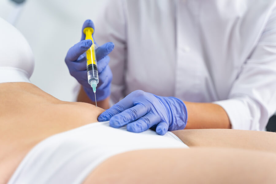Beneficios de la carboxiterapia: qué puede y qué no puede hacer