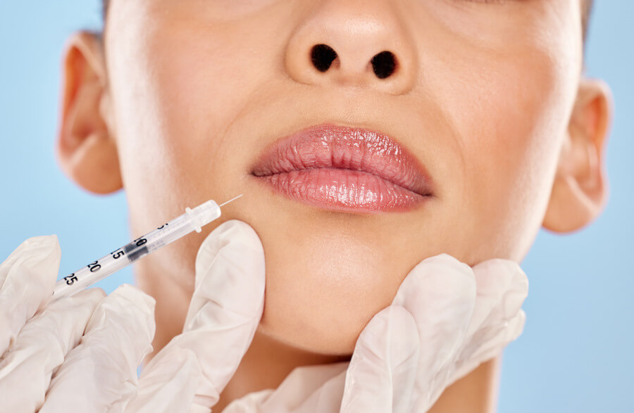 Carboxiterapia facial: qué trata y cómo actúa sobre la piel