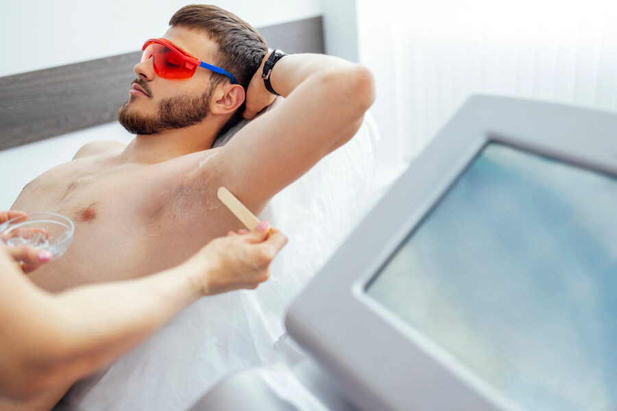 Depilación láser masculina en la zona de las axilas.