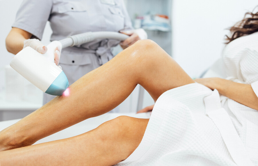 Depilación láser duele: qué sentirás realmente en cada zona y cómo lo manejamos en Acuarela Belleza