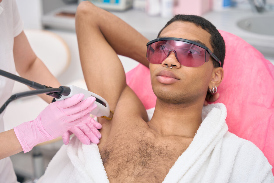 Depilación láser masculina en la zona de las axilas.