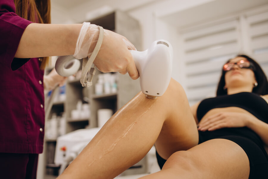 Depilación láser en las piernas con tecnología profesional.