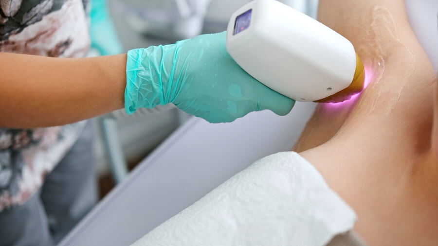 ¿Depilación láser sin dolor en Colombia: qué clínicas lo ofrecen?