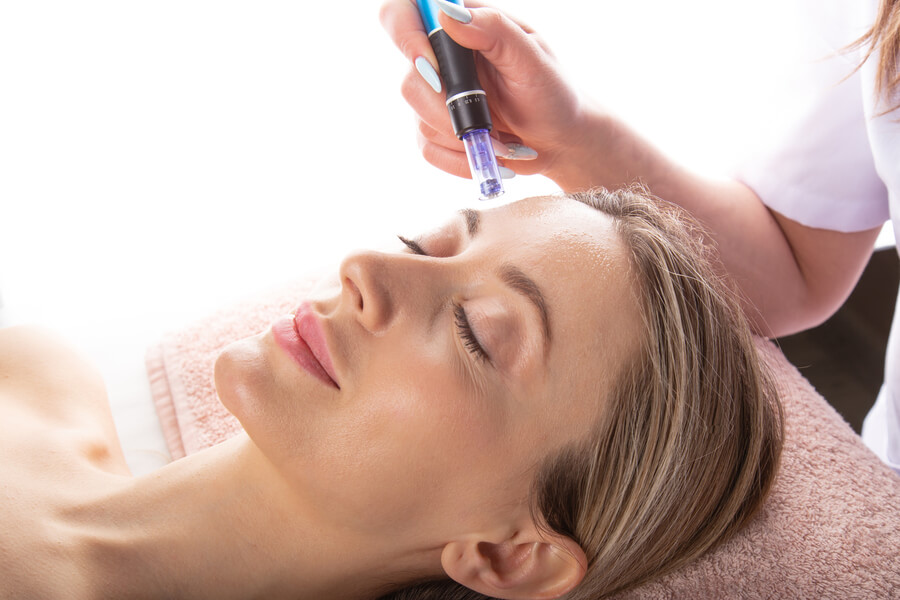 Dermapen: beneficios y desventajas y cuándo no aplicarlo