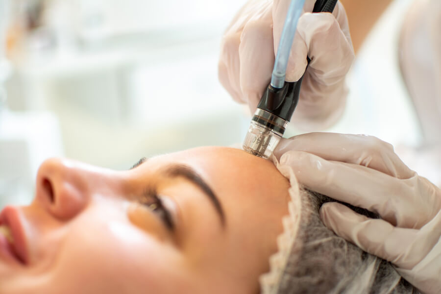 Dermapen y microneedling: diferencias, técnica y resultados