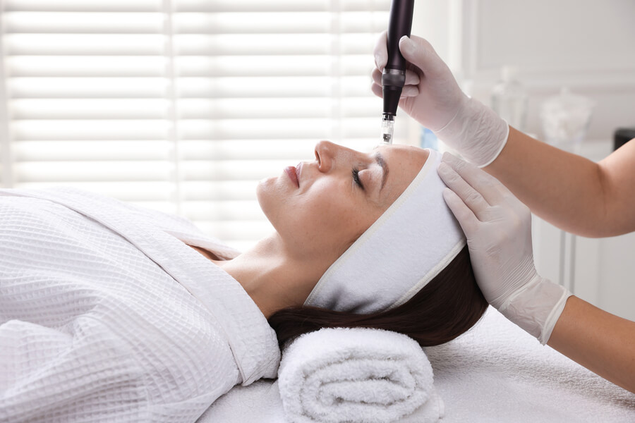 ¿Qué es el Dermapen y para qué sirve? Todo lo que necesitas saber