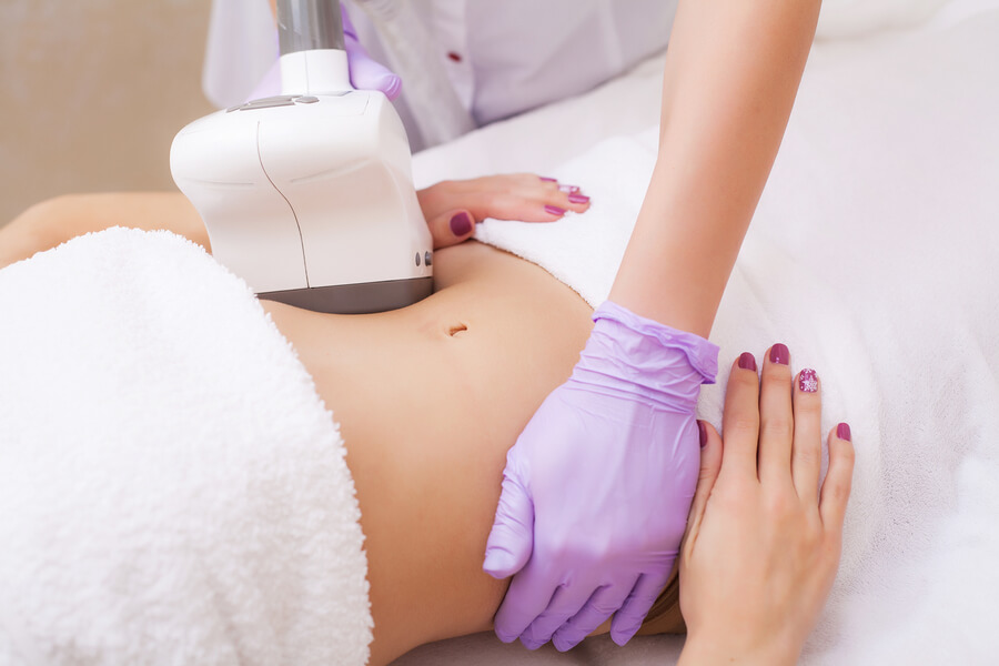 Sculptra en Brazos y Abdomen: ¿Funciona?