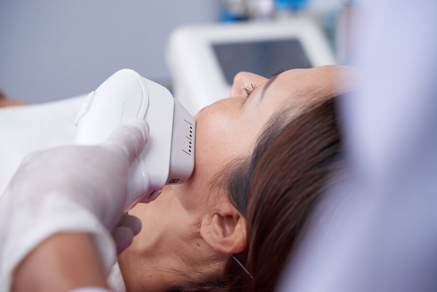 Cuánto Dura Sculptra: Línea de Tiempo de Resultados